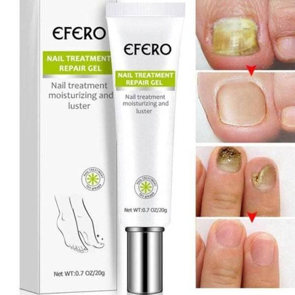 Efero Nail Treatment Repair Gel thumbnail 2