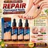 1pcs) Jaysuing Anti Paronychia Relief Oil 10 ml