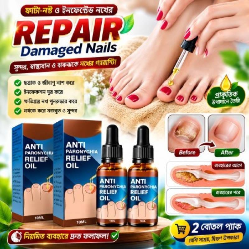 (3pcs) jaysuing Anti Paronychia Relief Oil 30 ml