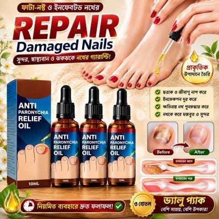 1pcs) Jaysuing Anti Paronychia Relief Oil 10 ml
